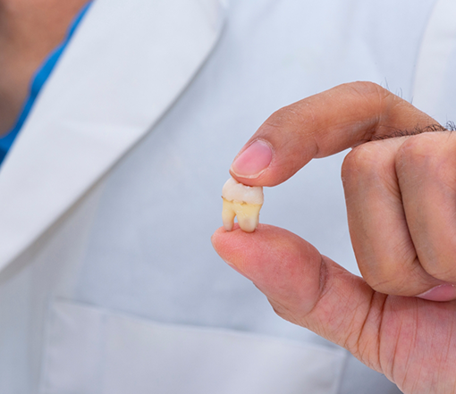 Dentist holding an extracted tooth
